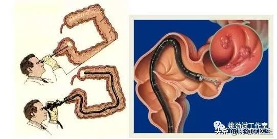 大便带血鲜红不疼吃啥西药,大便偶尔带血是怎么回事