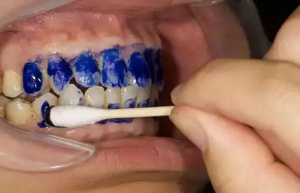 月子牙刷好用吗,月子牙刷好用么