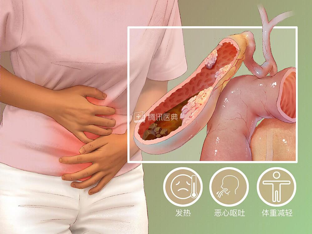 深圳癌症发病率最高的城市,深圳癌症多少例