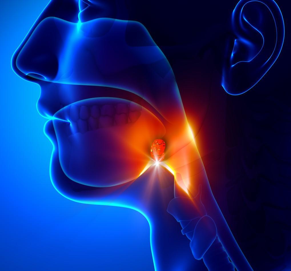 扁桃体总是发炎需要切掉吗,正常的扁桃体和发炎的扁桃体对比