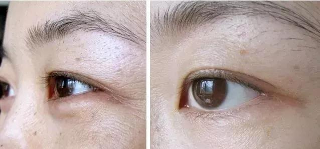 眼霜到底有没有用啊,眼霜里面有什么成分不能用