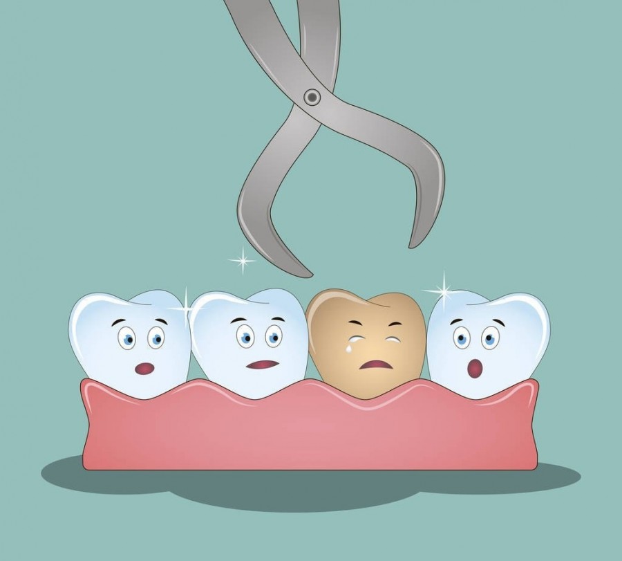 牙齿上有黑线怎么治多少钱,牙齿有黑线怎么办三招解决