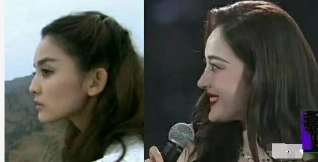 盘点一些有问题的鼻子,明星都没整好的鼻子