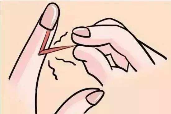 没有妇科问题的女性，手部通常会有这3种特征显现，快来看看
