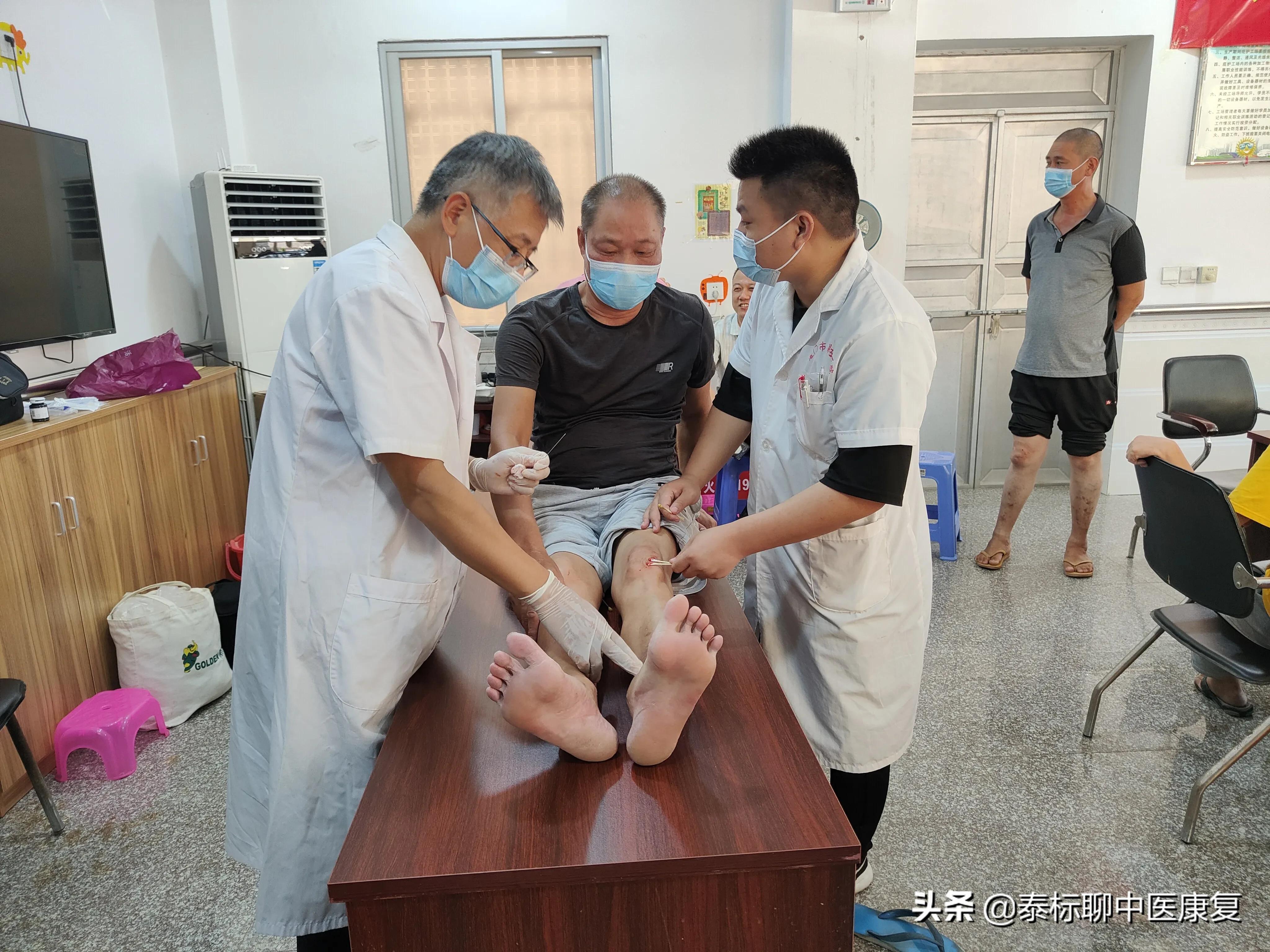 社区康复，针刀之喜与忧