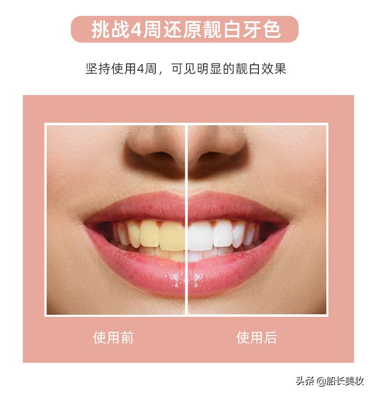 推荐一款能快速刷白牙齿的牙膏,一款能刷白牙的牙膏