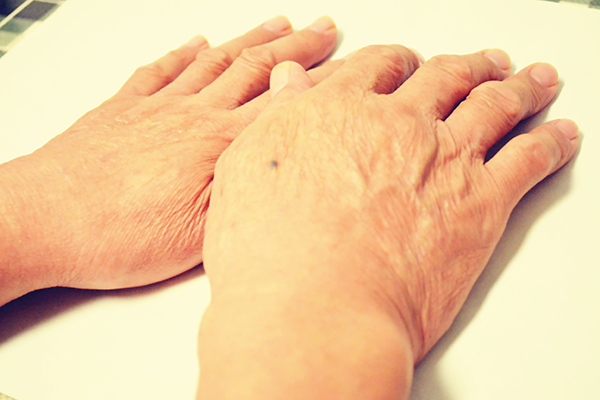 手脚有轻微的发麻怎么缓解,头发麻手脚发麻一整天是怎么回事