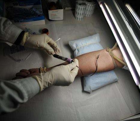 感染艾滋病早期症状多久会出现,你知道艾滋有什么症状不