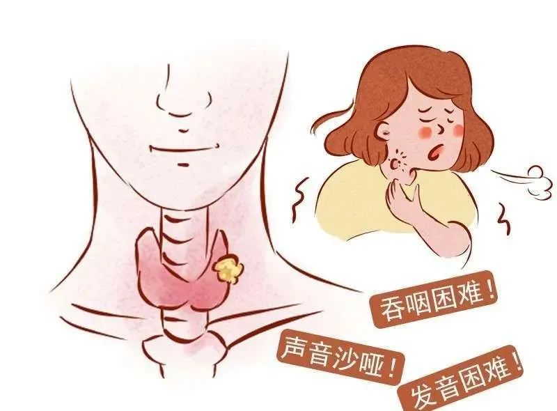 吞咽困难喝水呛咳十大原因,老年人吞咽障碍引发呛咳