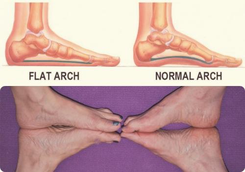 脚各个部位疼痛位置图解,脚疼和肿是什么原因