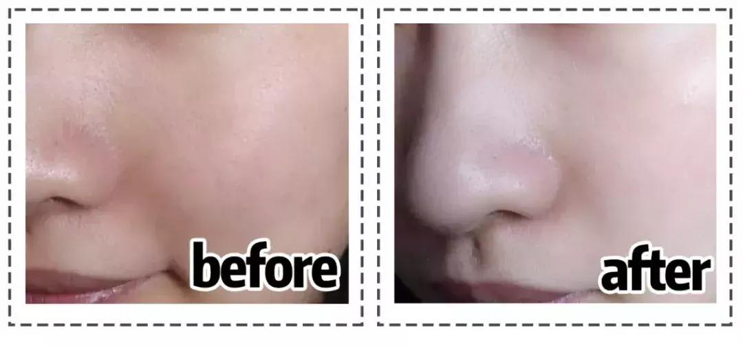 既能美白又抗老,既能美白又能抗衰老的护肤品