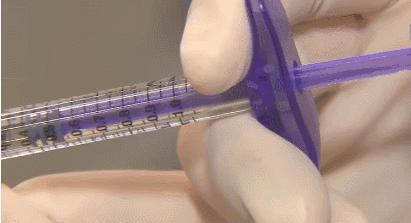 整形医院消除法令纹,医生消除法令纹