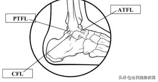 踝关节扭伤需要引起足够的重视,足踝扭伤的注意事项