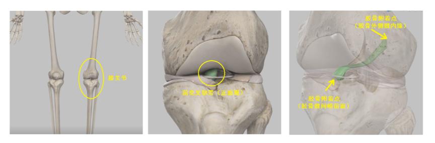 判断前交叉韧带断裂最简单的方法,前十字交叉韧带撕裂自测