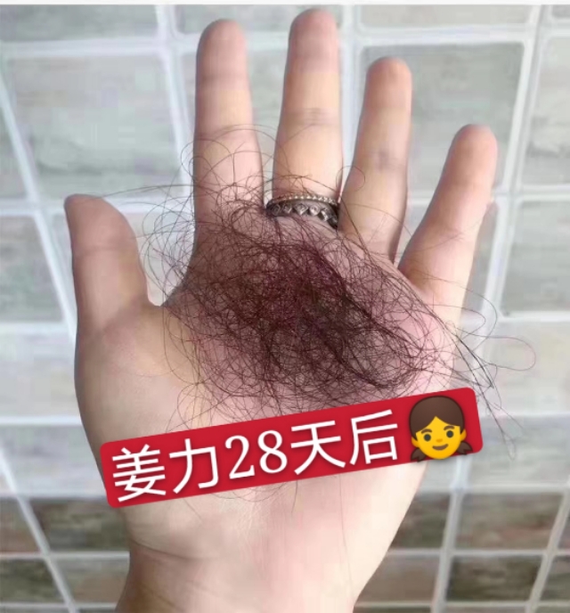 姜力洗发水防脱效果好吗,姜力一号生发洗发水