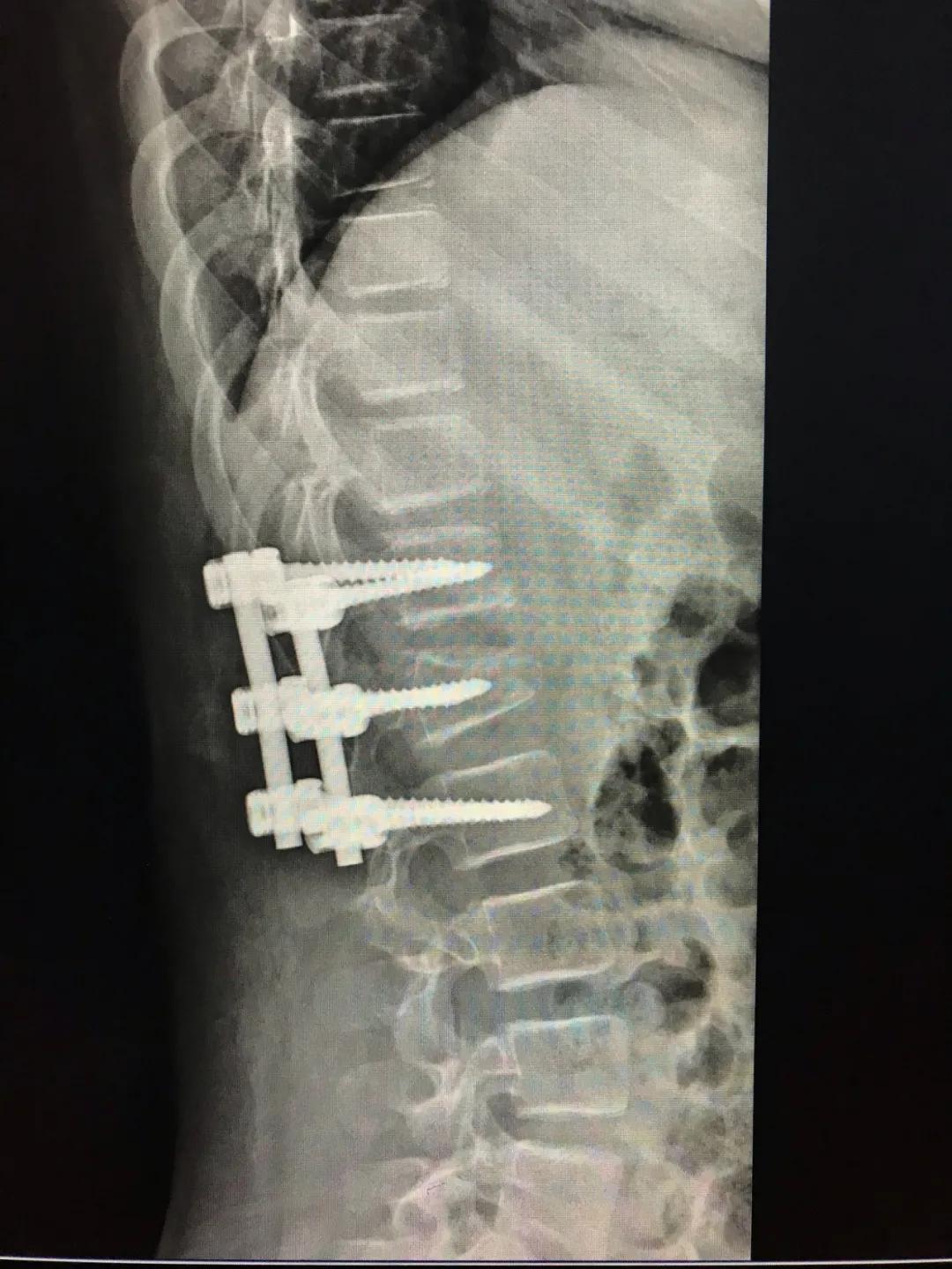 7岁小孩玩蹦床摔成错位,如何安全给小孩玩蹦床不伤膝盖