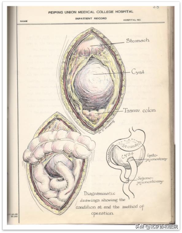 北京协和医院张太平新乡,北京协和医院张太平专家介绍