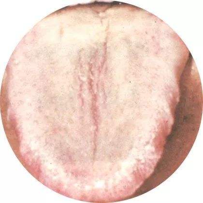 胃肠病是否会同时有痰湿困租、脾肾阳虚、肺胃阴虚等好几种症型呢