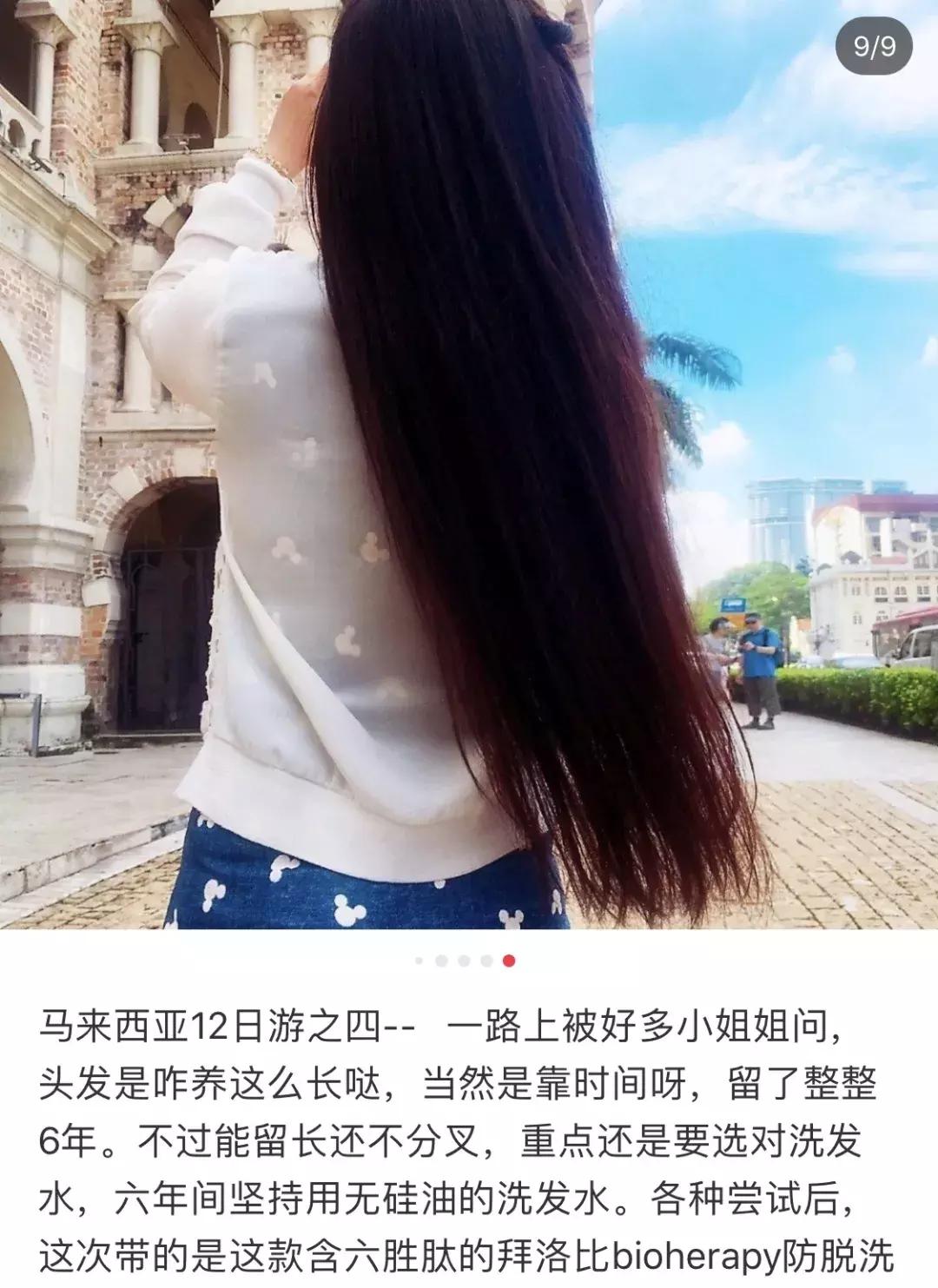 头发毛躁并且脱发推荐洗发水,用什么洗发水改善头皮脱发