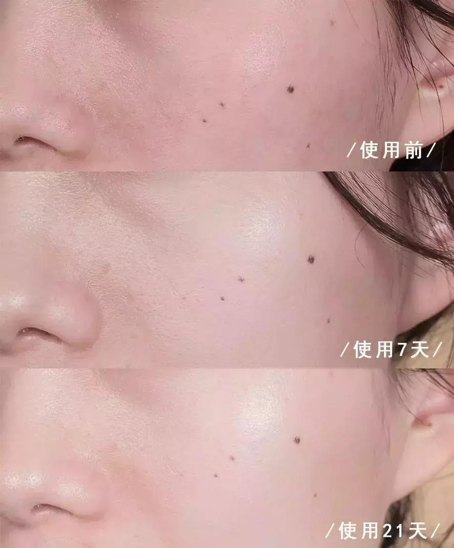 沈梦辰美白精华,沈梦辰推荐的美白精华液