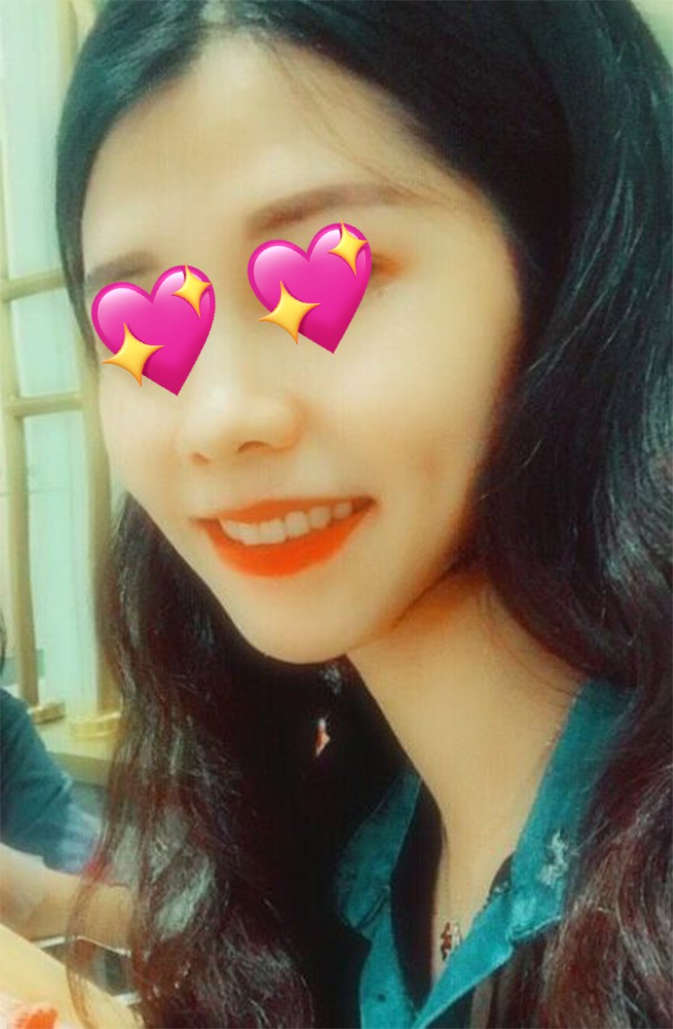 整牙齿堪比整容,矫正牙齿大概多少钱龅牙