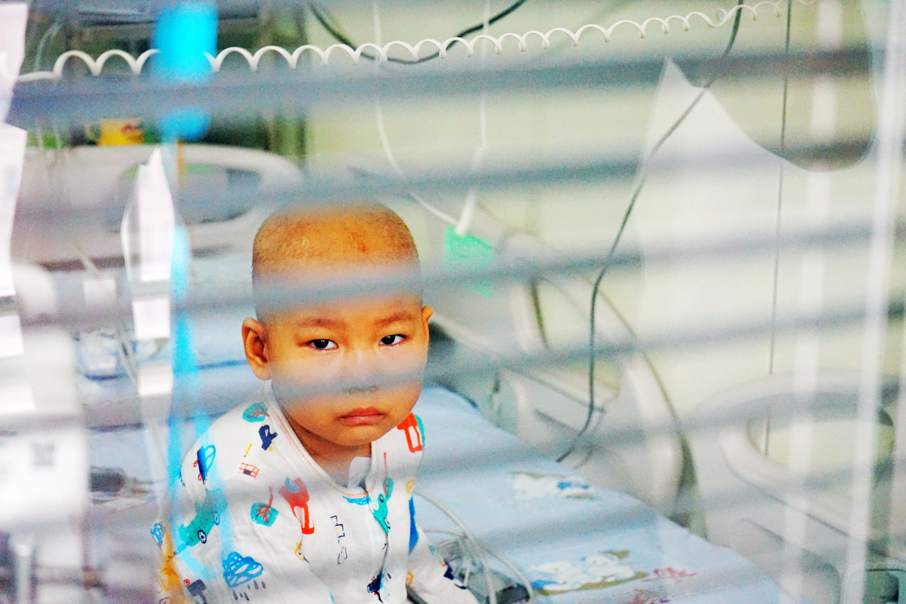 湖北4岁女孩生病致脸部毁容，需“割肉”治疗，爸爸门外放声大哭