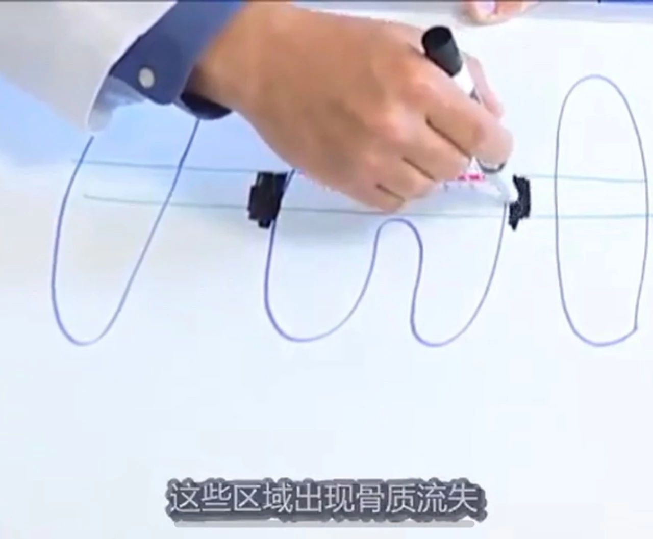 猫有牙周炎该怎么治疗,猫有牙龈炎怎么治疗