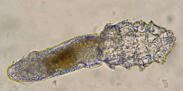 脸上的螨虫分泌物,脸部毛孔有螨怎么解决