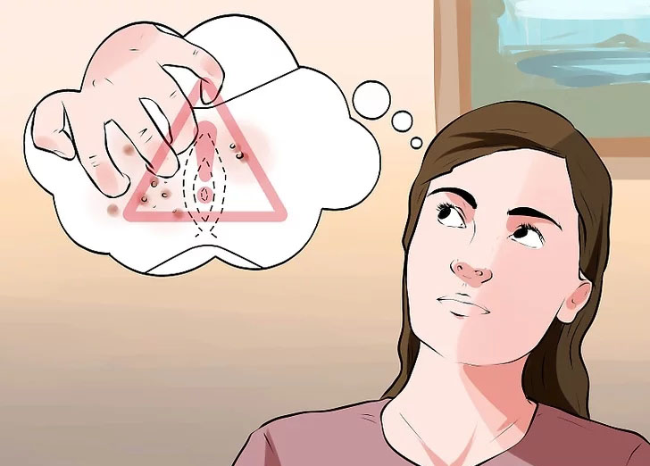 外阴白斑物理治疗,治疗外阴白斑口服药