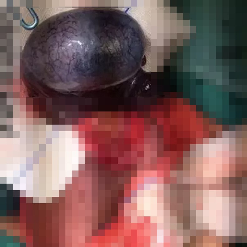 涓轰粈涔堜笉鐩镐俊鍖荤敓,涓轰粈涔堝ぇ浜轰笉鐩镐俊鍖荤敓