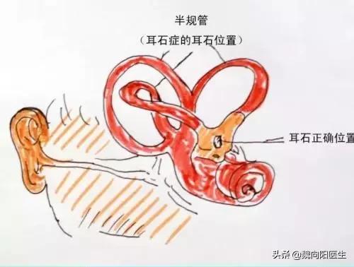 治疗眩晕头晕哪个医院好,头晕眩晕中医看什么科