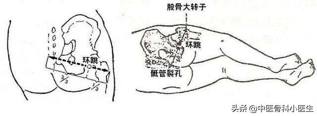 足少阳胆经推拿,跟着老中医学三个动作