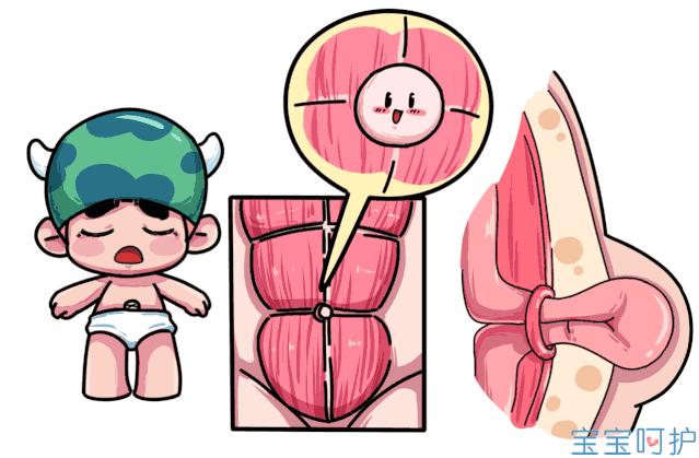 小儿脐疝多久自愈,小儿脐疝可以自行恢复吗