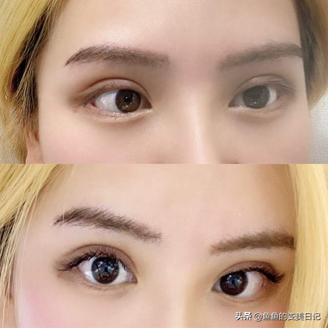 双眼皮知识点总结大全,关于双眼皮的十大真相