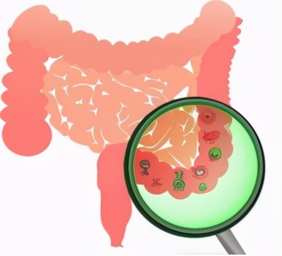 如何分辨肠道是否健康,肠道疾病怎样识别