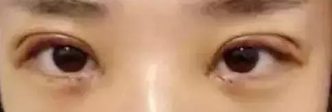 1元脱毛靠谱吗,0元免费脱毛