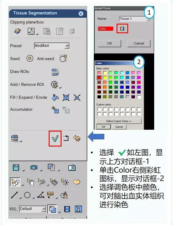 ct后处理重建技术,ct后处理技巧