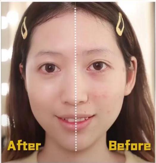 干皮如何避免底妆很快氧化暗沉,干皮如何化底妆遮盖雀斑