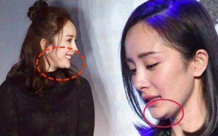 那些一刀切削骨的明星还好吗？后遗症一大堆，小方脸成最大赢家