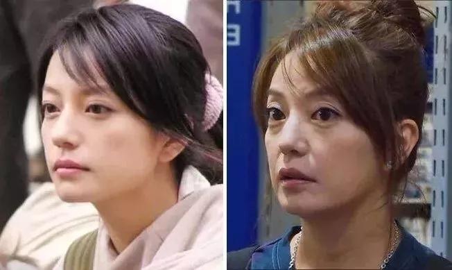 眼袋大显老试试这个方法简单实用,眼袋显老怎么办四种方法帮你去掉