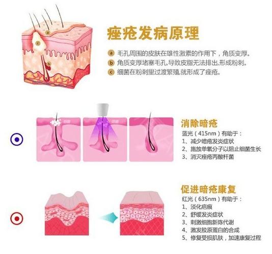 奥运选手都做了美甲,奥运换头选手