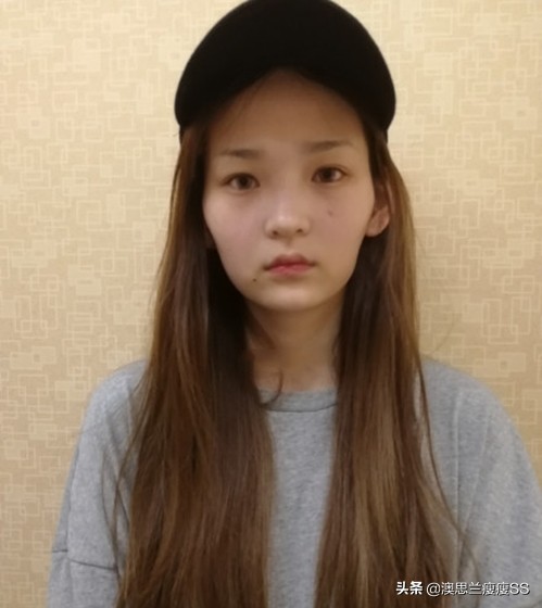 如何减掉顽固的脸颊肉？为什么减肥身上瘦了，脸还是又宽又胖？