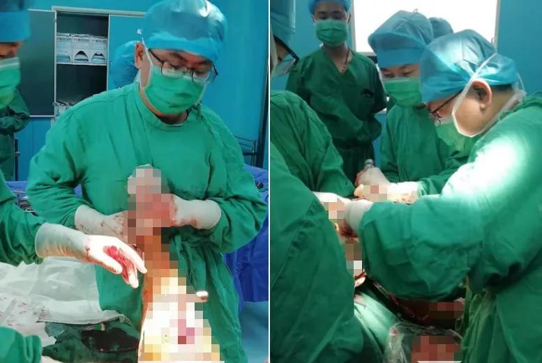 骨科高难度技术开展的好处,骨科中比较难的手术