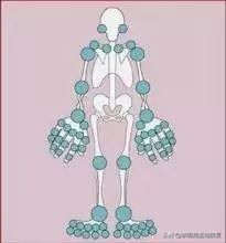 o型腿的自我鉴别及矫正方法,怎么知道o型腿是不是在慢慢变好