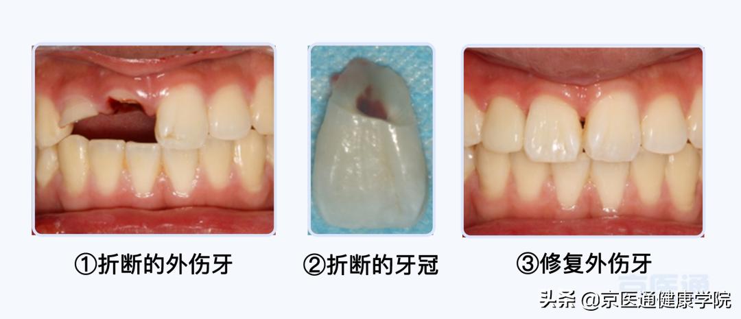 运动前怎么预防损伤,运动之前涂什么预防受伤