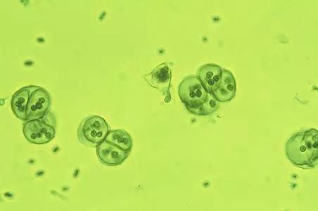 水产养殖治蓝藻最好方法,水产养殖蓝藻怎么防治