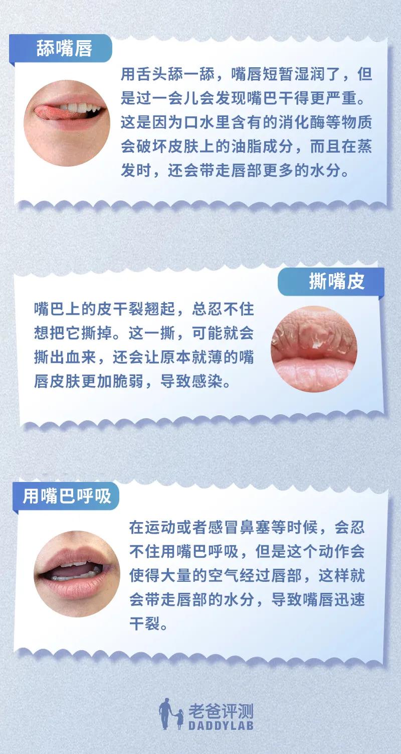 为什么天天涂唇膏嘴巴还是干,涂唇膏后嘴唇干怎么办