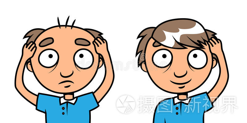 男性脱发吃非那雄胺有用吗,男性脱发用非那雄胺片副作用