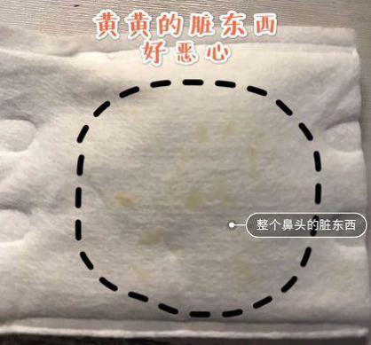 喷雾式的去黑头的东西,去黑头收缩毛孔吸黑头神器测评