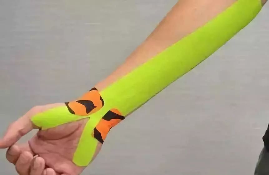 打羽毛球注意事项防止受伤,打羽毛球如何避免一切伤病